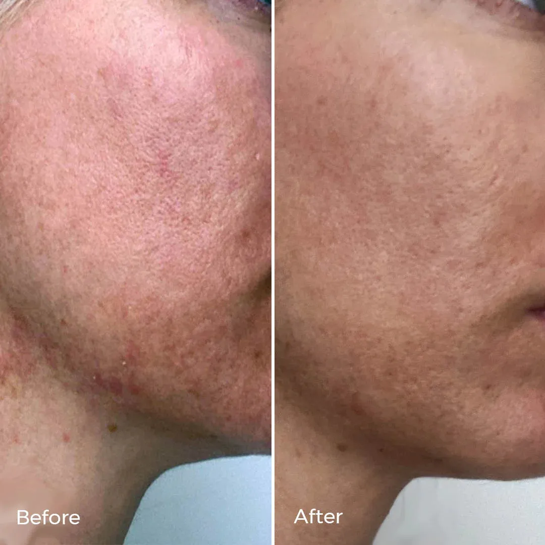 LUXE Botanics KIGELIA Corrective Serum